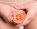 Rejuvenecimiento vaginal